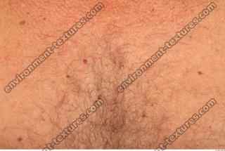 human skin hairy 0013